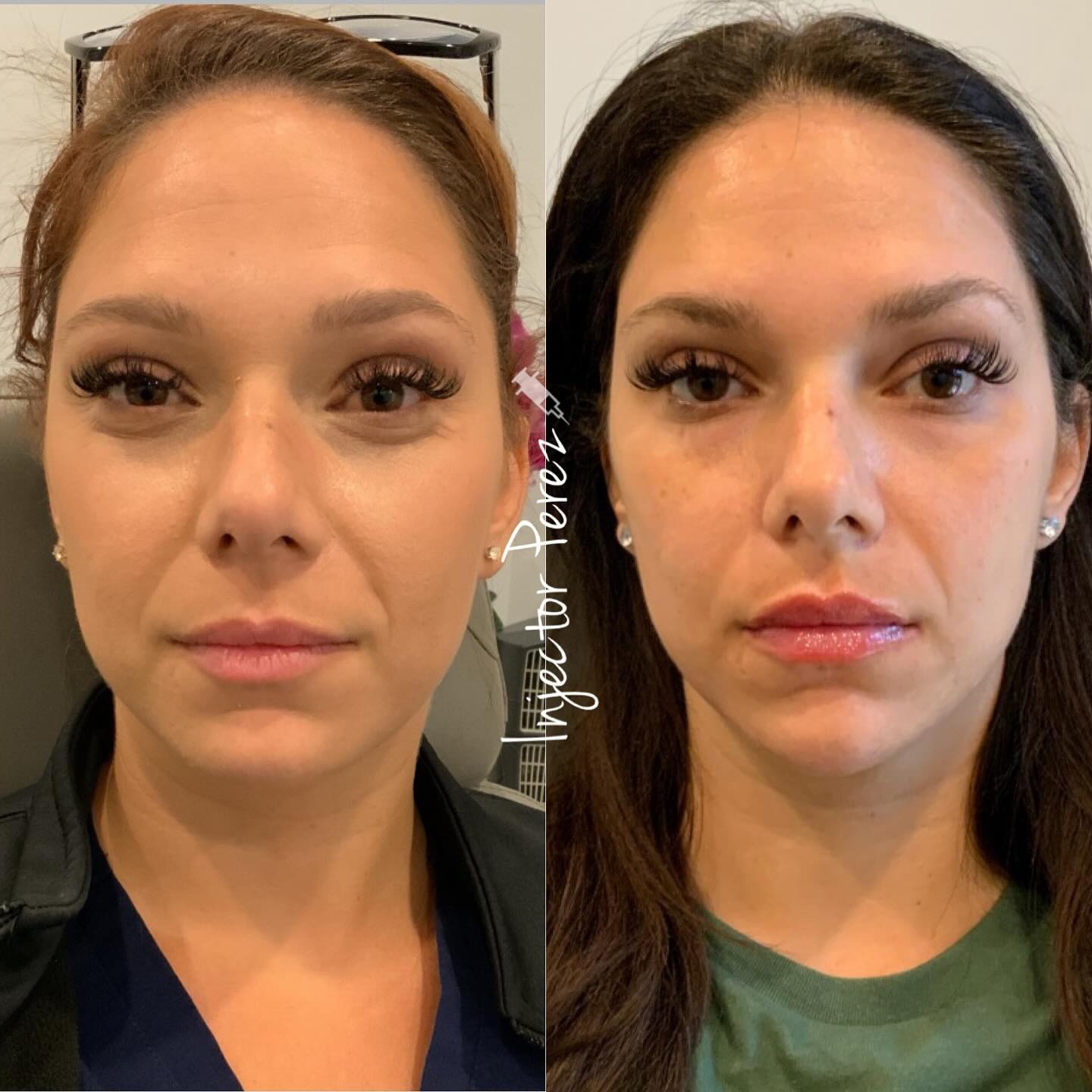 Lymphatic Drainage Wellness Drops